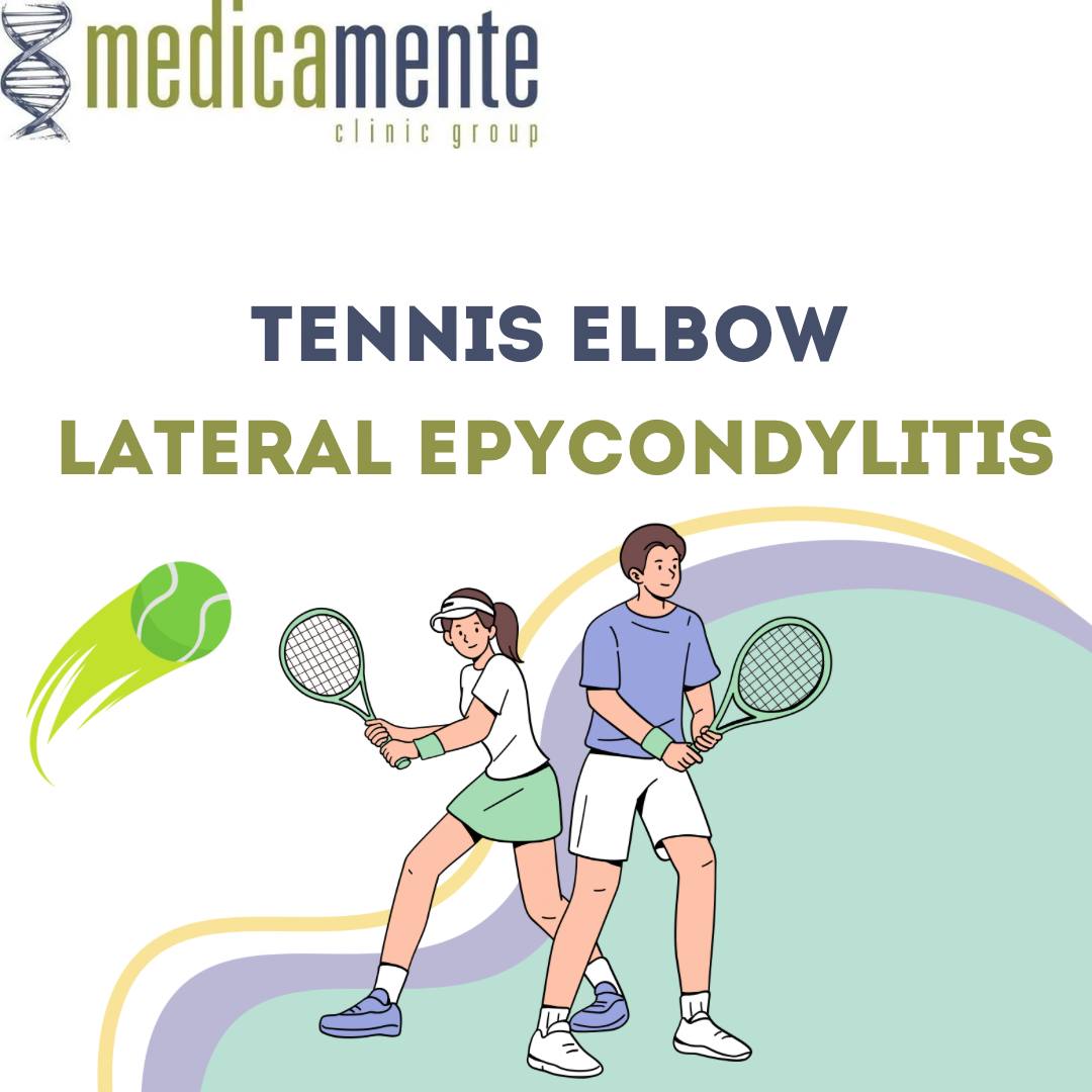 Lateral Epicondylitis (Tennis Elbow)